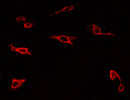 TLR4 Ab staining U-2 OS cells by IF/ICC.The secondary antibody (red) was Alexa Fluor? 594 goat anti-rabbit IgG (H+L)(