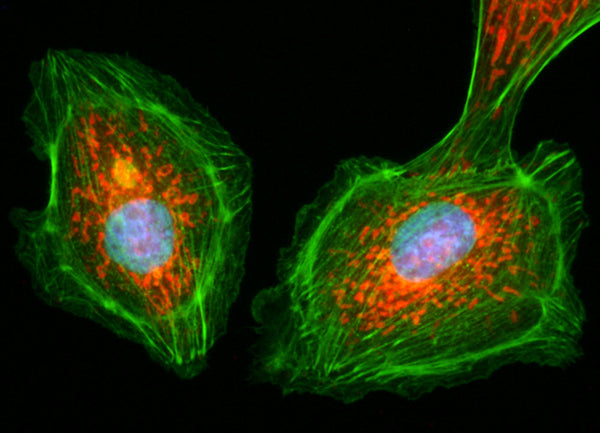 Green: Goat Anti-Rabbit IgG(H+L) FITC–conjugated
Blue: DAPI