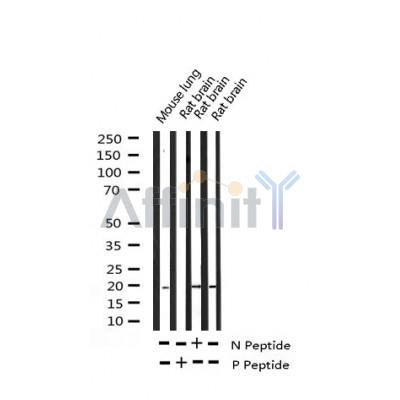 AF3194 staining Hela by IF/ICC. The sample were fixed with PFA and permeabilized in 0.1% Triton X-100,then blocked in 10% serum for 45 minutes at 25¡ãC. The primary antibody was diluted at 1/200 and incubated with the sample for 1 hour at 37¡ãC. An  Alexa Fluor 594 conjugated goat anti-rabbit IgG (H+L) Ab, diluted at 1/600, was used as the secondary antibod