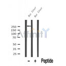 Western blot analysis of CdGAP expression in Rat liver lysate