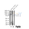 Western blot analysis of extracts from Mouse lung, using INCENP Antibody. The lane on the left was treated with blocking peptide.