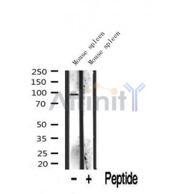 Western blot analysis of extracts from Mouse lung, using INCENP Antibody. The lane on the left was treated with blocking peptide.