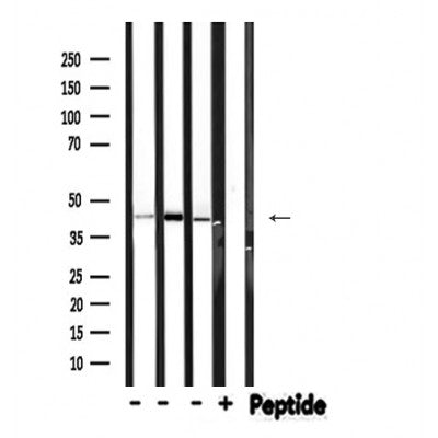 Western blot analysis of Phospho-HPD?T383) expression in various lysates