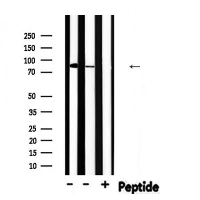 Western blot analysis of Phospho-PFKP?Y52? expression in various lysates