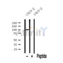 Western blot analysis of ROR1 expression in caco-2 lysate