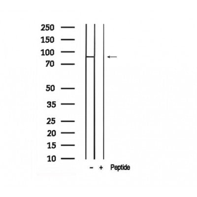 Western blot analysis of extracts from Jurkat, using Phospho-EZH2(S476) Antibody.