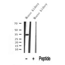 Western blot analysis of ketohexokinase expression in Mouse kidney lysate