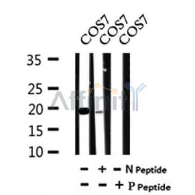 AF7031 at 1/100 staining mouse kidney tissue sections by IHC-P. The tissue was formaldehyde fixed and a heat mediated antigen retrieval step in citrate buffer was performed. The tissue was then blocked and incubated with the antibody for 1.5 hours at 22¡ãC. An HRP conjugated goat anti-rabbit antibody was used as the secondary