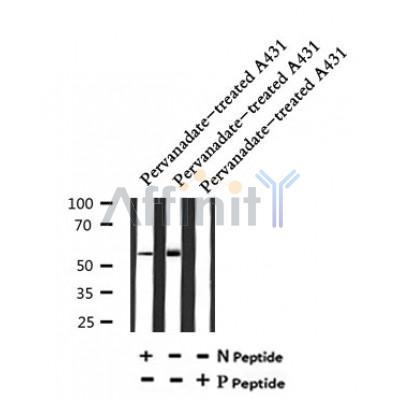 AF7032 at 1/100 staining mouse heart tissue sections by IHC-P. The tissue was formaldehyde fixed and a heat mediated antigen retrieval step in citrate buffer was performed. The tissue was then blocked and incubated with the antibody for 1.5 hours at 22¡ãC. An HRP conjugated goat anti-rabbit antibody was used as the secondary