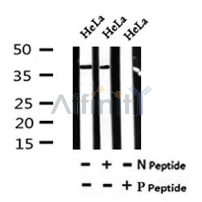 AF7037 at 1/100 staining mouse kidney tissue sections by IHC-P. The tissue was formaldehyde fixed and a heat mediated antigen retrieval step in citrate buffer was performed. The tissue was then blocked and incubated with the antibody for 1.5 hours at 22¡ãC. An HRP conjugated goat anti-rabbit antibody was used as the secondary