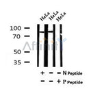 AF7038 at 1/100 staining mouse kidney tissue sections by IHC-P. The tissue was formaldehyde fixed and a heat mediated antigen retrieval step in citrate buffer was performed. The tissue was then blocked and incubated with the antibody for 1.5 hours at 22¡ãC. An HRP conjugated goat anti-rabbit antibody was used as the secondary