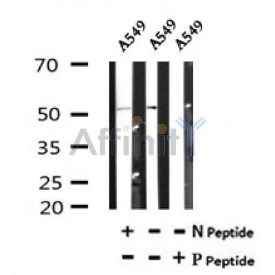 AF7042 at 1/100 staining human kidney tissue sections by IHC-P. The tissue was formaldehyde fixed and a heat mediated antigen retrieval step in citrate buffer was performed. The tissue was then blocked and incubated with the antibody for 1.5 hours at 22¡ãC. An HRP conjugated goat anti-rabbit antibody was used as the secondary