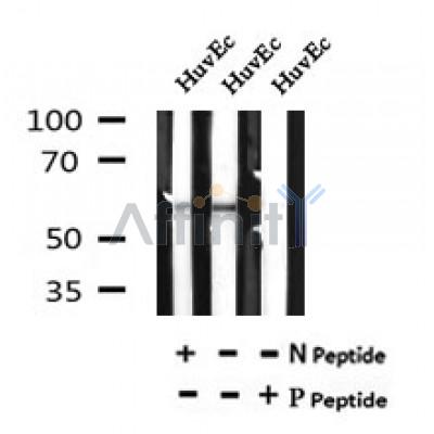 Western blot analysis of Phospho-KCNA1(Ser446) in lysates of HuvEc , using Phospho-KCNA1(Ser446) Antibody(AF7043).
