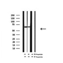 AF7046 at 1/100 staining human kidney tissue sections by IHC-P. The tissue was formaldehyde fixed and a heat mediated antigen retrieval step in citrate buffer was performed. The tissue was then blocked and incubated with the antibody for 1.5 hours at 22¡ãC. An HRP conjugated goat anti-rabbit antibody was used as the secondary