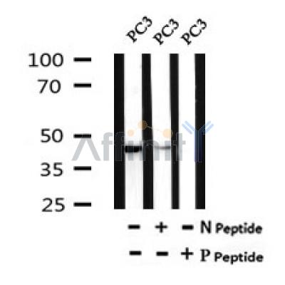 AF7056 at 1/100 staining mouse kidney tissue sections by IHC-P. The tissue was formaldehyde fixed and a heat mediated antigen retrieval step in citrate buffer was performed. The tissue was then blocked and incubated with the antibody for 1.5 hours at 22¡ãC. An HRP conjugated goat anti-rabbit antibody was used as the secondary