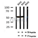 AF7057 at 1/100 staining mouse kidney tissue sections by IHC-P. The tissue was formaldehyde fixed and a heat mediated antigen retrieval step in citrate buffer was performed. The tissue was then blocked and incubated with the antibody for 1.5 hours at 22¡ãC. An HRP conjugated goat anti-rabbit antibody was used as the secondary