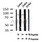 Western blot analysis of Phospho-BCL11A(Ser265) in lysates of Jurkat, using Phospho-BCL11A(Ser265) Antibody(AF7061).