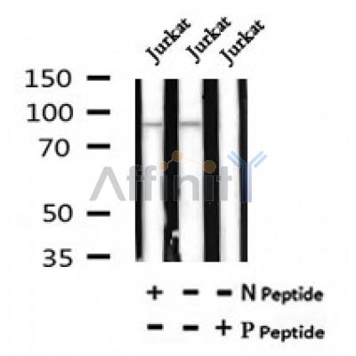 Western blot analysis of Phospho-BCL11A(Ser265) in lysates of Jurkat, using Phospho-BCL11A(Ser265) Antibody(AF7061).