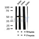 AF7065 at 1/100 staining mouse kidney tissue sections by IHC-P. The tissue was formaldehyde fixed and a heat mediated antigen retrieval step in citrate buffer was performed. The tissue was then blocked and incubated with the antibody for 1.5 hours at 22¡ãC. An HRP conjugated goat anti-rabbit antibody was used as the secondary