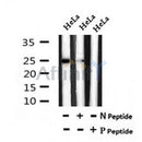 AF7067 at 1/100 staining rat kidney tissue sections by IHC-P. The tissue was formaldehyde fixed and a heat mediated antigen retrieval step in citrate buffer was performed. The tissue was then blocked and incubated with the antibody for 1.5 hours at 22¡ãC. An HRP conjugated goat anti-rabbit antibody was used as the secondary