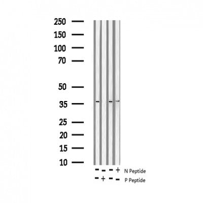 AF3200 staining K562 by IF/ICC. The sample were fixed with PFA and permeabilized in 0.1% Triton X-100,then blocked in 10% serum for 45 minutes at 25¡ãC. The primary antibody was diluted at 1/200 and incubated with the sample for 1 hour at 37¡ãC. An  Alexa Fluor 594 conjugated goat anti-rabbit IgG (H+L) Ab, diluted at 1/600, was used as the secondary antibod