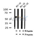 AF7068 at 1/100 staining mouse lung tissue sections by IHC-P. The tissue was formaldehyde fixed and a heat mediated antigen retrieval step in citrate buffer was performed. The tissue was then blocked and incubated with the antibody for 1.5 hours at 22¡ãC. An HRP conjugated goat anti-rabbit antibody was used as the secondary