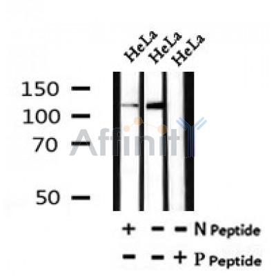 Western blot analysis of Phospho-GLI2(Ser234) in lysates of HeLa?, using Phospho-GLI2(Ser234) Antibody(AF7072).