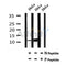 Western blot analysis of Phospho-TXN(Thr100) in lysates of HeLa , using Phospho-TXN(Thr100) Antibody(AF7077).