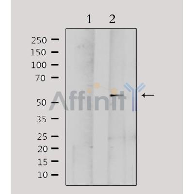 Western blot analysis of extracts from Hela, using MMP1 Antibody. Lane 1 was treated with the antigen-specific peptide.