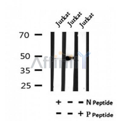 Western blot analysis of Phospho-CASP2(Ser340) in lysates of Jurkat , using Phospho-CASP2(Ser340) Antibody(AF7078).