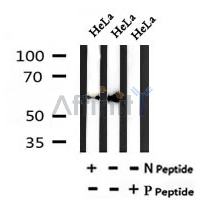 AF7084 at 1/100 staining mouse heart tissue sections by IHC-P. The tissue was formaldehyde fixed and a heat mediated antigen retrieval step in citrate buffer was performed. The tissue was then blocked and incubated with the antibody for 1.5 hours at 22¡ãC. An HRP conjugated goat anti-rabbit antibody was used as the secondary