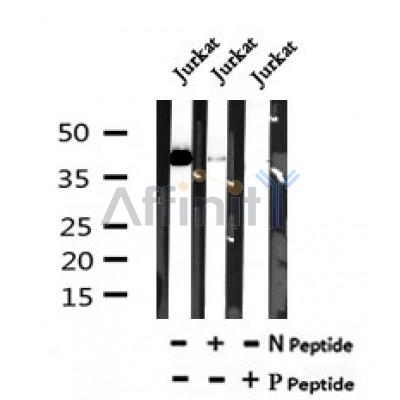 AF7087 at 1/100 staining human kidney tissue sections by IHC-P. The tissue was formaldehyde fixed and a heat mediated antigen retrieval step in citrate buffer was performed. The tissue was then blocked and incubated with the antibody for 1.5 hours at 22¡ãC. An HRP conjugated goat anti-rabbit antibody was used as the secondary