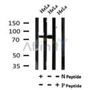AF7088 at 1/100 staining human liver tissue sections by IHC-P. The tissue was formaldehyde fixed and a heat mediated antigen retrieval step in citrate buffer was performed. The tissue was then blocked and incubated with the antibody for 1.5 hours at 22¡ãC. An HRP conjugated goat anti-rabbit antibody was used as the secondary