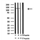 AF7093 at 1/100 staining human kidney tissue sections by IHC-P. The tissue was formaldehyde fixed and a heat mediated antigen retrieval step in citrate buffer was performed. The tissue was then blocked and incubated with the antibody for 1.5 hours at 22¡ãC. An HRP conjugated goat anti-rabbit antibody was used as the secondary