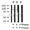 Western blot analysis of Phospho-MuSK (Tyr751) in lysates of JK, using Phospho-MuSK (Tyr751) Antibody(AF7107).