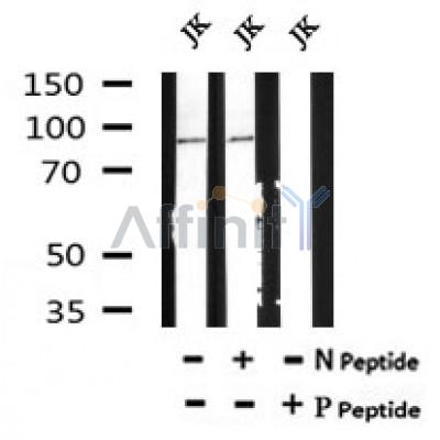 Western blot analysis of Phospho-MuSK (Tyr751) in lysates of JK, using Phospho-MuSK (Tyr751) Antibody(AF7107).