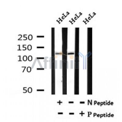 AF7112 at 1/100 staining mouse kidney tissue sections by IHC-P. The tissue was formaldehyde fixed and a heat mediated antigen retrieval step in citrate buffer was performed. The tissue was then blocked and incubated with the antibody for 1.5 hours at 22¡ãC. An HRP conjugated goat anti-rabbit antibody was used as the secondary