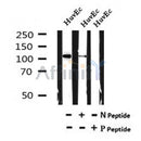 AF7135 at 1/100 staining mouse lung tissue sections by IHC-P. The tissue was formaldehyde fixed and a heat mediated antigen retrieval step in citrate buffer was performed. The tissue was then blocked and incubated with the antibody for 1.5 hours at 22¡ãC. An HRP conjugated goat anti-rabbit antibody was used as the secondary