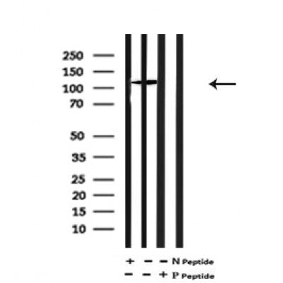 AF7149 at 1/100 staining mouse heart tissue sections by IHC-P. The tissue was formaldehyde fixed and a heat mediated antigen retrieval step in citrate buffer was performed. The tissue was then blocked and incubated with the antibody for 1.5 hours at 22¡ãC. An HRP conjugated goat anti-rabbit antibody was used as the secondary