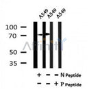 AF7152 at 1/100 staining rat lung tissue sections by IHC-P. The tissue was formaldehyde fixed and a heat mediated antigen retrieval step in citrate buffer was performed. The tissue was then blocked and incubated with the antibody for 1.5 hours at 22¡ãC. An HRP conjugated goat anti-rabbit antibody was used as the secondary