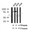 AF7152 at 1/100 staining rat lung tissue sections by IHC-P. The tissue was formaldehyde fixed and a heat mediated antigen retrieval step in citrate buffer was performed. The tissue was then blocked and incubated with the antibody for 1.5 hours at 22¡ãC. An HRP conjugated goat anti-rabbit antibody was used as the secondary