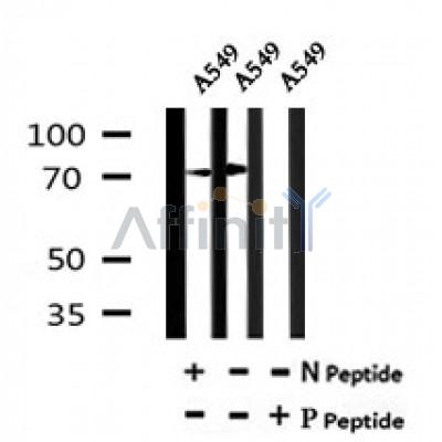 AF7152 at 1/100 staining rat lung tissue sections by IHC-P. The tissue was formaldehyde fixed and a heat mediated antigen retrieval step in citrate buffer was performed. The tissue was then blocked and incubated with the antibody for 1.5 hours at 22¡ãC. An HRP conjugated goat anti-rabbit antibody was used as the secondary
