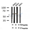 AF7154 at 1/100 staining mouse brain tissue sections by IHC-P. The tissue was formaldehyde fixed and a heat mediated antigen retrieval step in citrate buffer was performed. The tissue was then blocked and incubated with the antibody for 1.5 hours at 22¡ãC. An HRP conjugated goat anti-rabbit antibody was used as the secondary