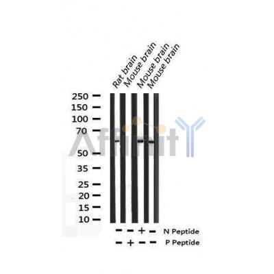 AF3213 staining HeLa by IF/ICC. The sample were fixed with PFA and permeabilized in 0.1% Triton X-100,then blocked in 10% serum for 45 minutes at 25¡ãC. The primary antibody was diluted at 1/200 and incubated with the sample for 1 hour at 37¡ãC. An  Alexa Fluor 594 conjugated goat anti-rabbit IgG (H+L) Ab, diluted at 1/600, was used as the secondary antibod