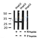 AF7166 at 1/100 staining mouse lung tissue sections by IHC-P. The tissue was formaldehyde fixed and a heat mediated antigen retrieval step in citrate buffer was performed. The tissue was then blocked and incubated with the antibody for 1.5 hours at 22¡ãC. An HRP conjugated goat anti-rabbit antibody was used as the secondary