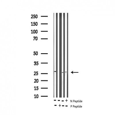 Western blot analysis of Phospho-TNNI3 (Thr142) expression in various lysates