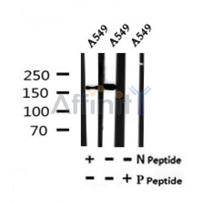 AF7169 at 1/100 staining mouse heart tissue sections by IHC-P. The tissue was formaldehyde fixed and a heat mediated antigen retrieval step in citrate buffer was performed. The tissue was then blocked and incubated with the antibody for 1.5 hours at 22¡ãC. An HRP conjugated goat anti-rabbit antibody was used as the secondary
