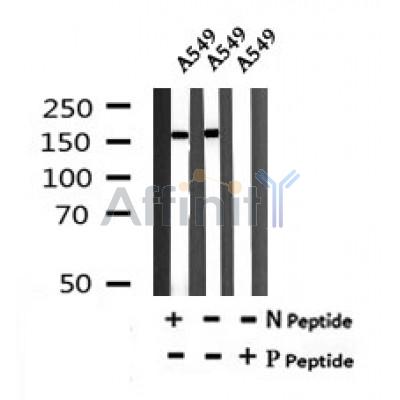 AF7171 at 1/100 staining mouse brain tissue sections by IHC-P. The tissue was formaldehyde fixed and a heat mediated antigen retrieval step in citrate buffer was performed. The tissue was then blocked and incubated with the antibody for 1.5 hours at 22¡ãC. An HRP conjugated goat anti-rabbit antibody was used as the secondary