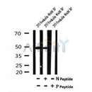 Western blot analysis of Phospho-Myc (Ser293) in lysates of 293 Forskolin 40nM 30', using Phospho-Myc (Ser293) Antibody(AF7174).