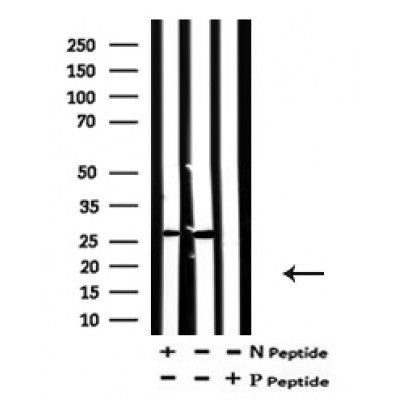 AF7176 at 1/100 staining mouse spleen tissue sections by IHC-P. The tissue was formaldehyde fixed and a heat mediated antigen retrieval step in citrate buffer was performed. The tissue was then blocked and incubated with the antibody for 1.5 hours at 22¡ãC. An HRP conjugated goat anti-rabbit antibody was used as the secondary